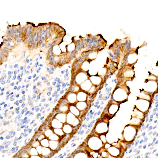 Villin Rabbit monoclonal antibody