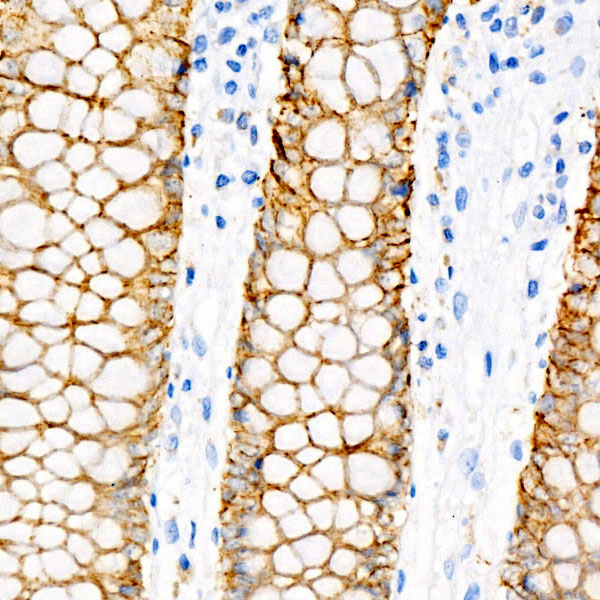 Villin Rabbit monoclonal antibody