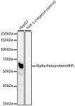 Western blot - Alpha-Fetoprotein (AFP) Rabbit mAb (A22053)