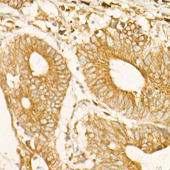 ADAM9 Rabbit monoclonal antibody