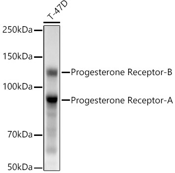 Progesterone Receptor Rabbit monoclonal antibody