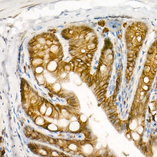 APC Rabbit monoclonal antibody
