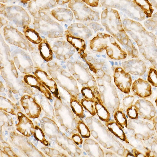 APC Rabbit monoclonal antibody