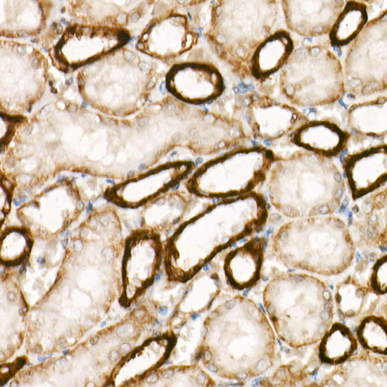 APC Rabbit monoclonal antibody
