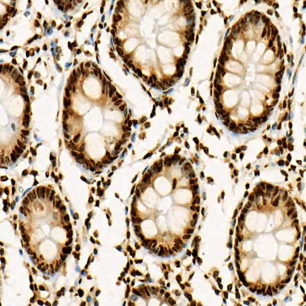 Acetyl-Histone H3-K27 Rabbit monoclonal antibody