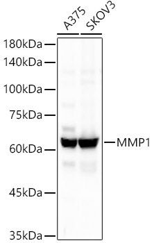 MMP1 Rabbit monoclonal antibody