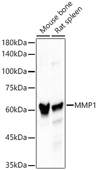 MMP1 Rabbit monoclonal antibody