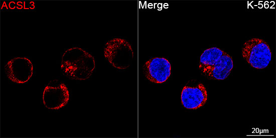ACSL3 Rabbit monoclonal antibody