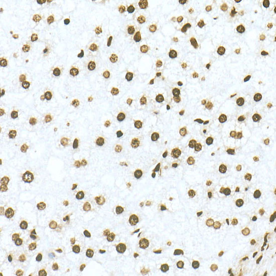 DiMethyl-Histone H3-K79 Rabbit monoclonal antibody