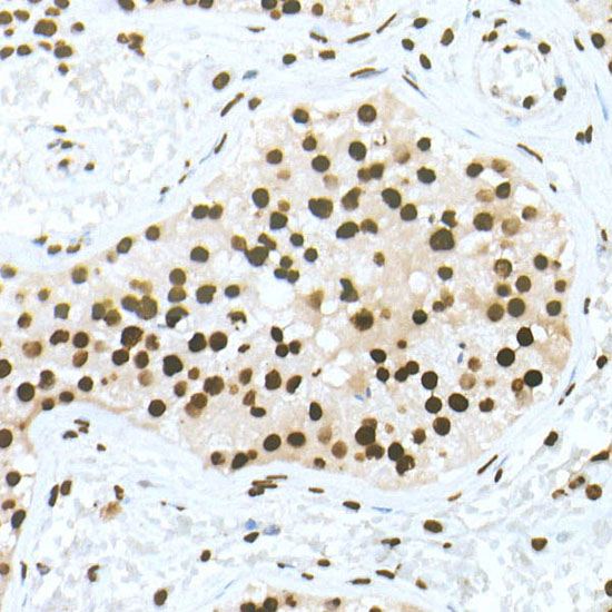 DiMethyl-Histone H3-K79 Rabbit monoclonal antibody