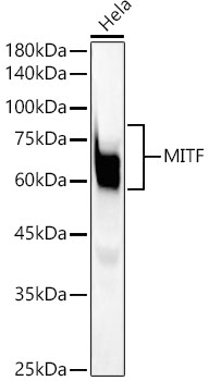 MITF Rabbit monoclonal antibody