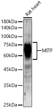 MITF Rabbit monoclonal antibody