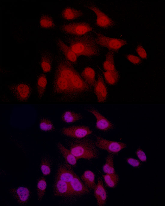 MITF Rabbit monoclonal antibody