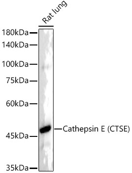 Cathepsin E (CTSE) Rabbit monoclonal antibody