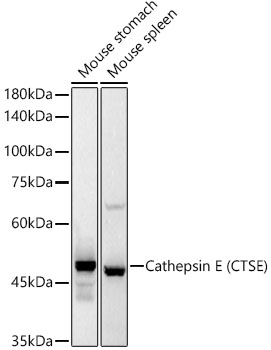 Cathepsin E (CTSE) Rabbit monoclonal antibody