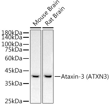 Ataxin-3 (ATXN3) Rabbit mAb