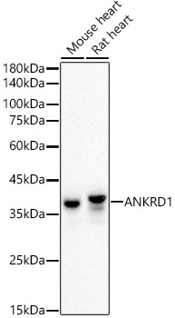 ANKRD1 Rabbit mAb