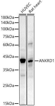 ANKRD1 Rabbit mAb