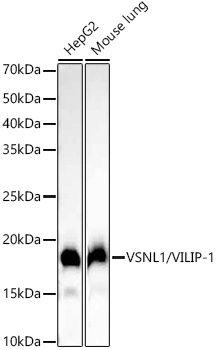 VSNL1/VILIP-1 Rabbit monoclonal antibody