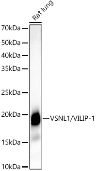 VSNL1/VILIP-1 Rabbit monoclonal antibody
