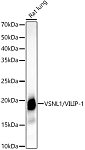 Western blot - VSNL1/VILIP-1 Rabbit mAb (A22100)