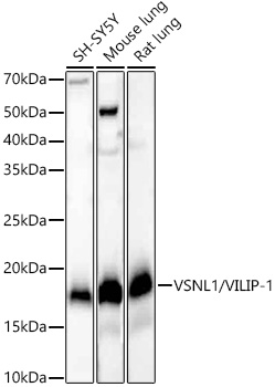 VSNL1/VILIP-1 Rabbit mAb