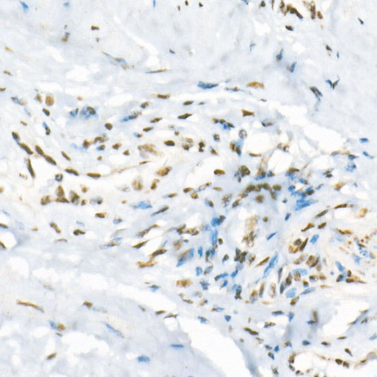 ATR Rabbit monoclonal antibody