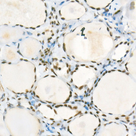 ATR Rabbit monoclonal antibody