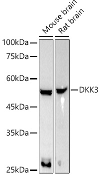 DKK3 Rabbit monoclonal antibody