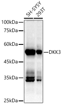 DKK3 Rabbit monoclonal antibody