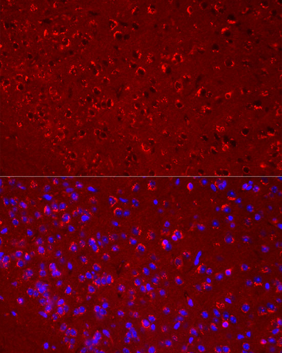 DKK3 Rabbit monoclonal antibody