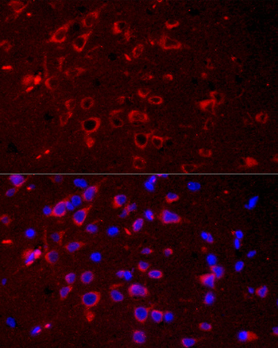 DKK3 Rabbit monoclonal antibody