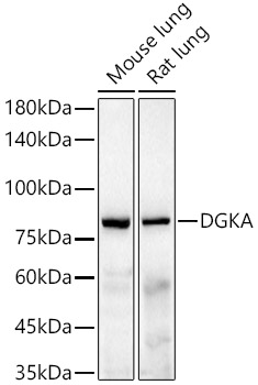 DGKA Rabbit monoclonal antibody