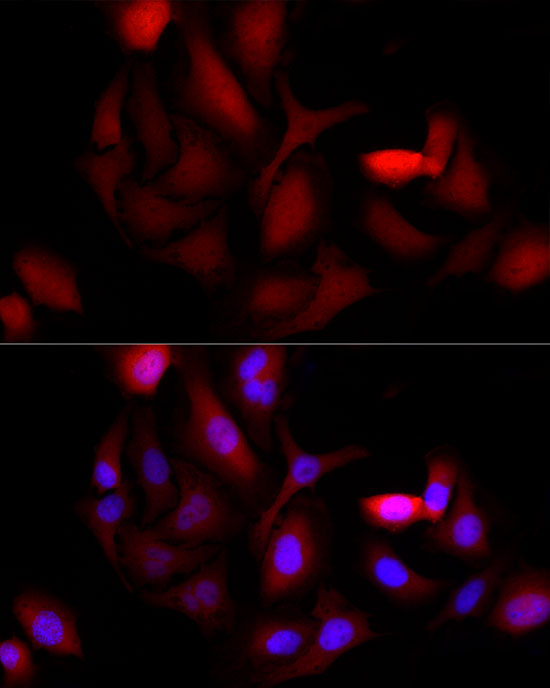 AKR1B1 Rabbit monoclonal antibody