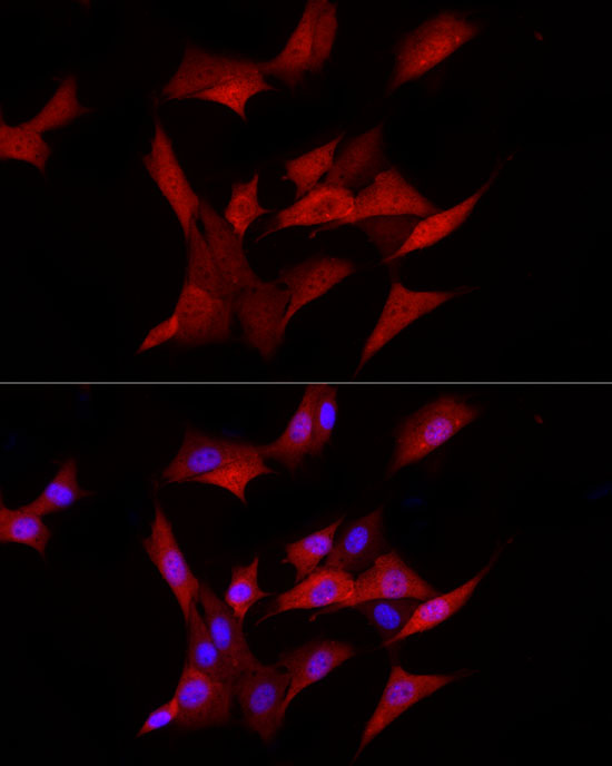 AKR1B1 Rabbit monoclonal antibody