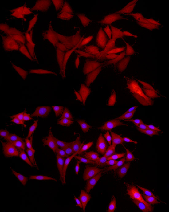 AKR1B1 Rabbit monoclonal antibody