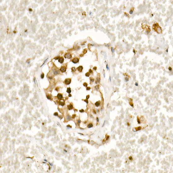 [KO Validated] Smad3 Rabbit monoclonal antibody