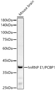 hnRNP E1/PCBP1 Rabbit mAb