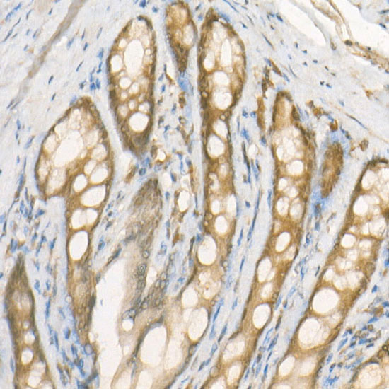 NADPH oxidase 4 (NOX4) Rabbit monoclonal antibody