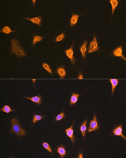 ALIX / PDCD6IP Rabbit polyclonal antibody