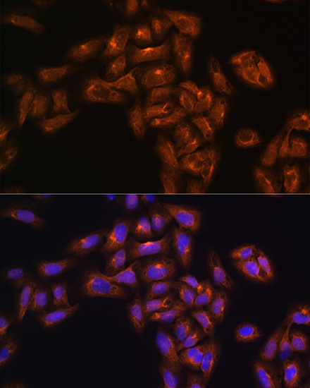 ALIX / PDCD6IP Rabbit polyclonal antibody