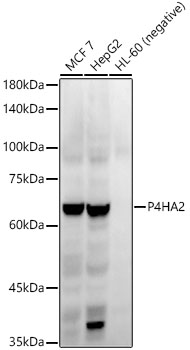 P4HA2 Rabbit monoclonal antibody