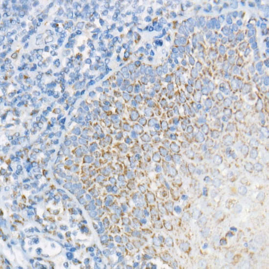 NDUFS3 Rabbit monoclonal antibody
