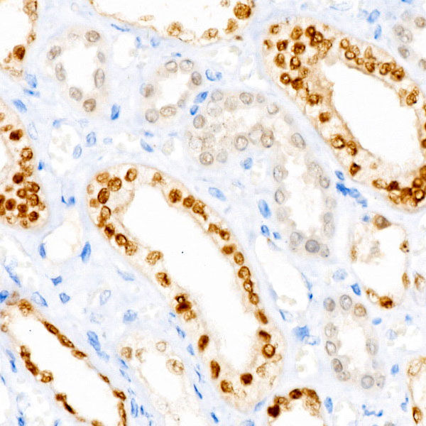 PAX8 Rabbit monoclonal antibody