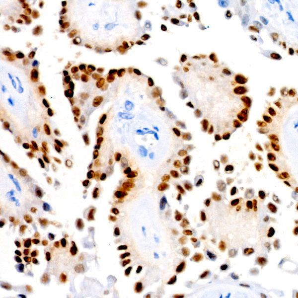 PAX8 Rabbit monoclonal antibody