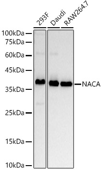 NACA Rabbit monoclonal antibody
