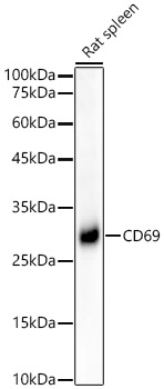 CD69 Rabbit monoclonal antibody