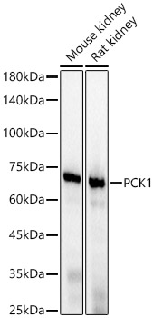 PCK1 Rabbit monoclonal antibody