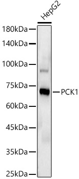 PCK1 Rabbit monoclonal antibody