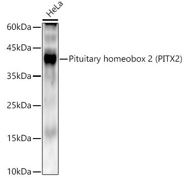ABclonal:Western blot - Pituitary homeobox 2 (PITX2) Rabbit mAb (A22173)}